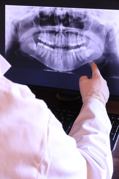 Best Emergency Care for Gum Disease in Fort Loramie, OH