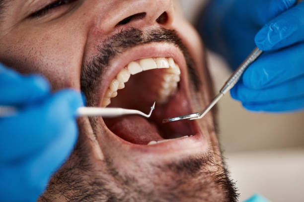 Best Emergency Treatment for Oral Infections in Fort Loramie, OH