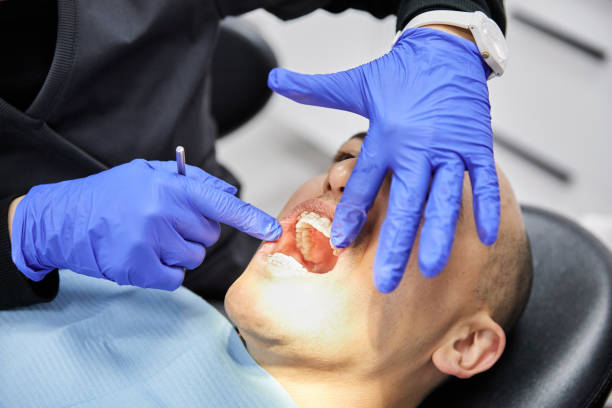 Best Emergency Care for Gum Disease in Fort Loramie, OH