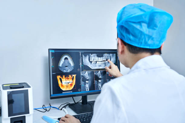 Best Emergency Wisdom Tooth Extraction in Fort Loramie, OH